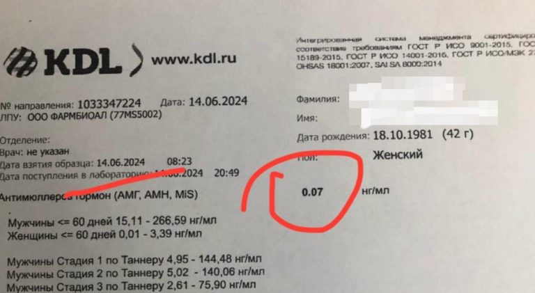 Антимюллеров гормон: Успешный случай восстановления уровня АМГ