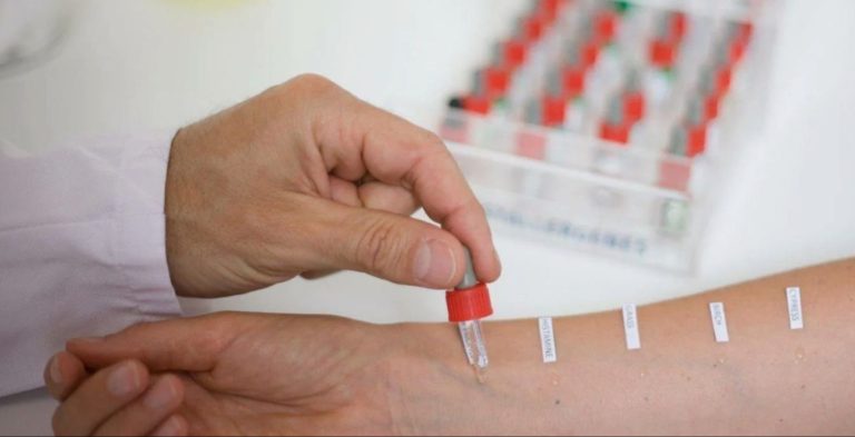 Какие симптомы указывают на необходимость прохождения теста на аллергию?